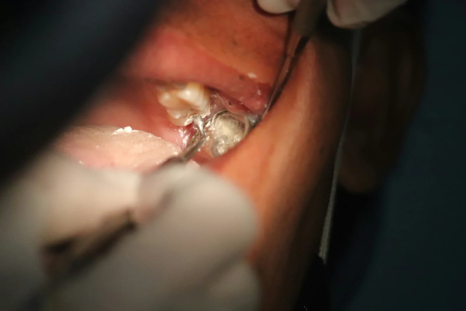 Cirugía Oral