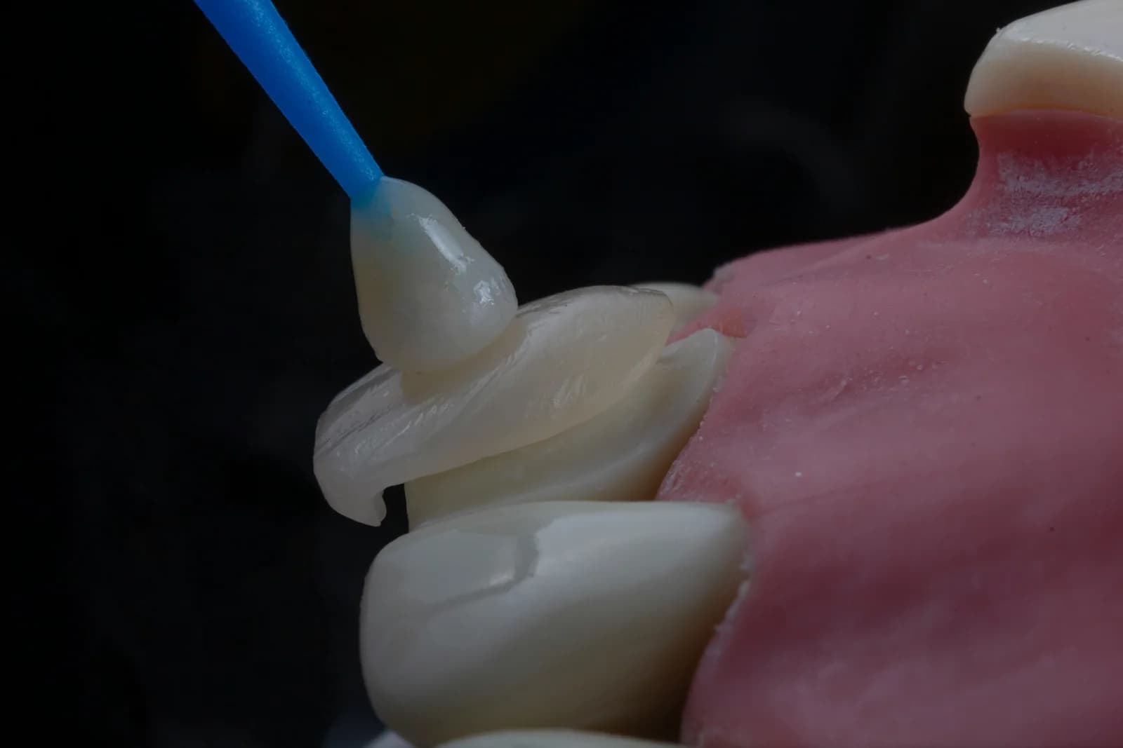 Odontología Estética