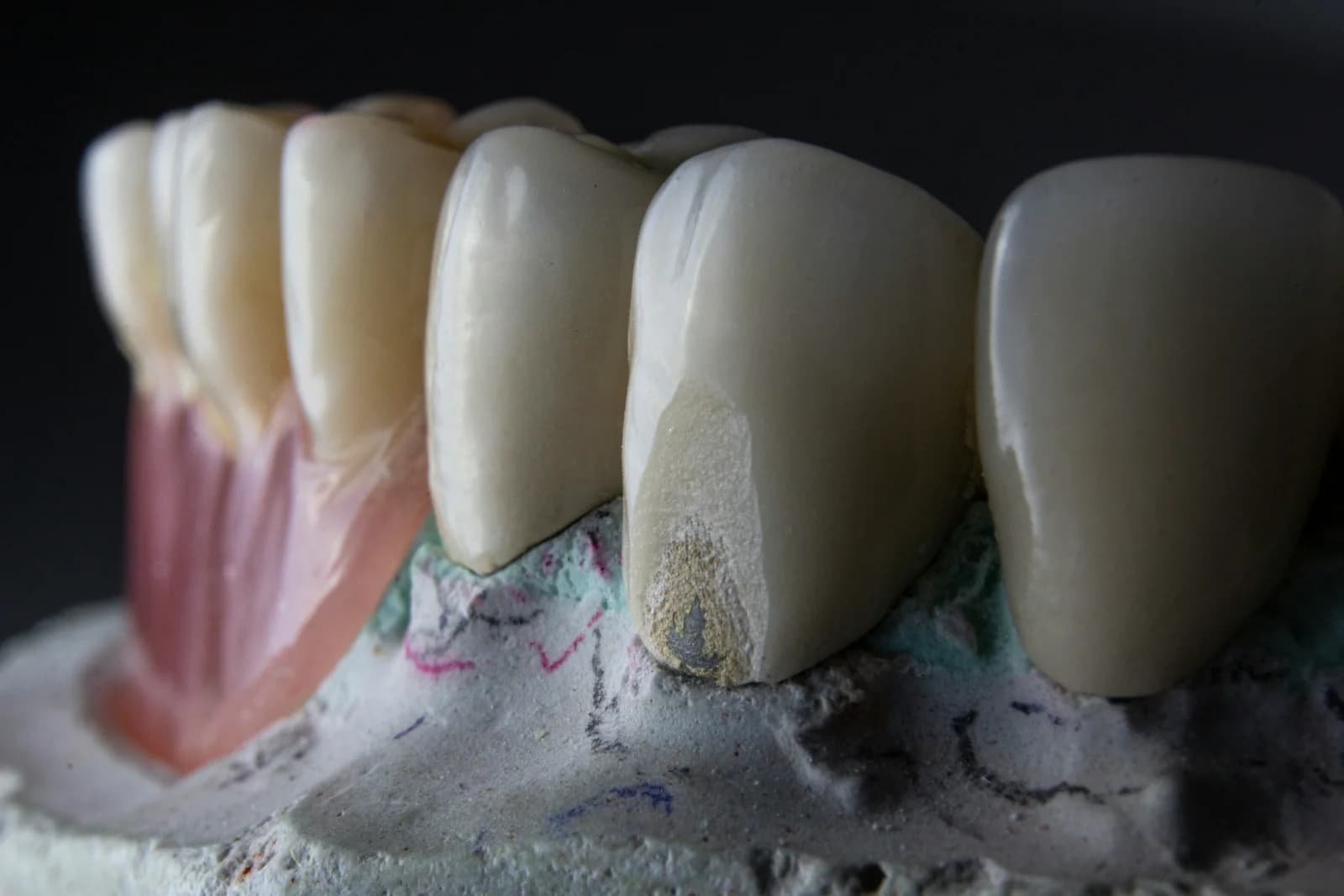 Periodoncia
