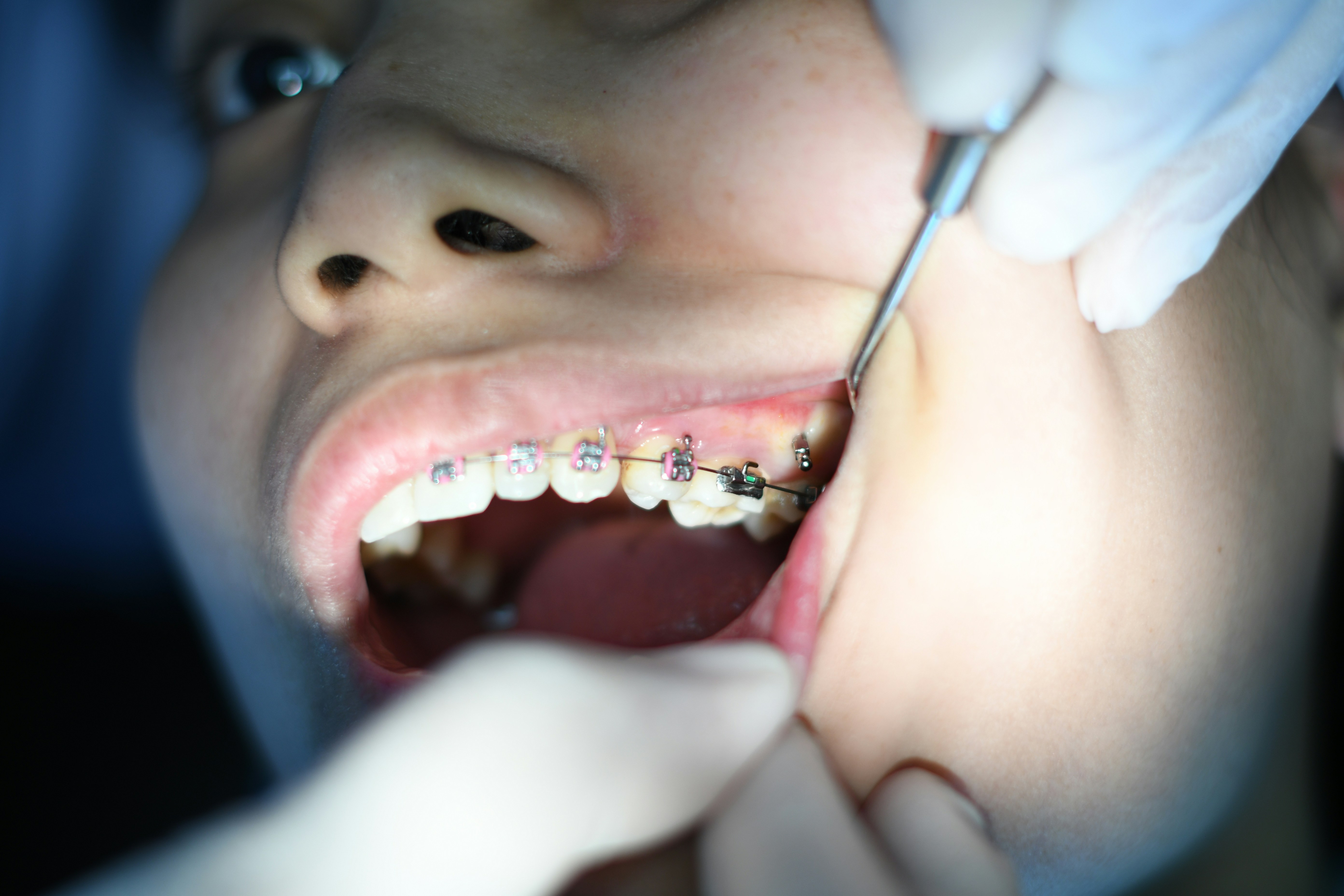 Servicio de ortodoncia oral en dentalcare